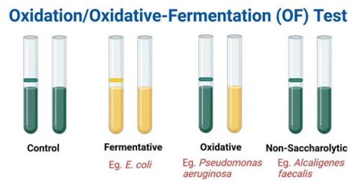 How do you test for oxidation fermentation?