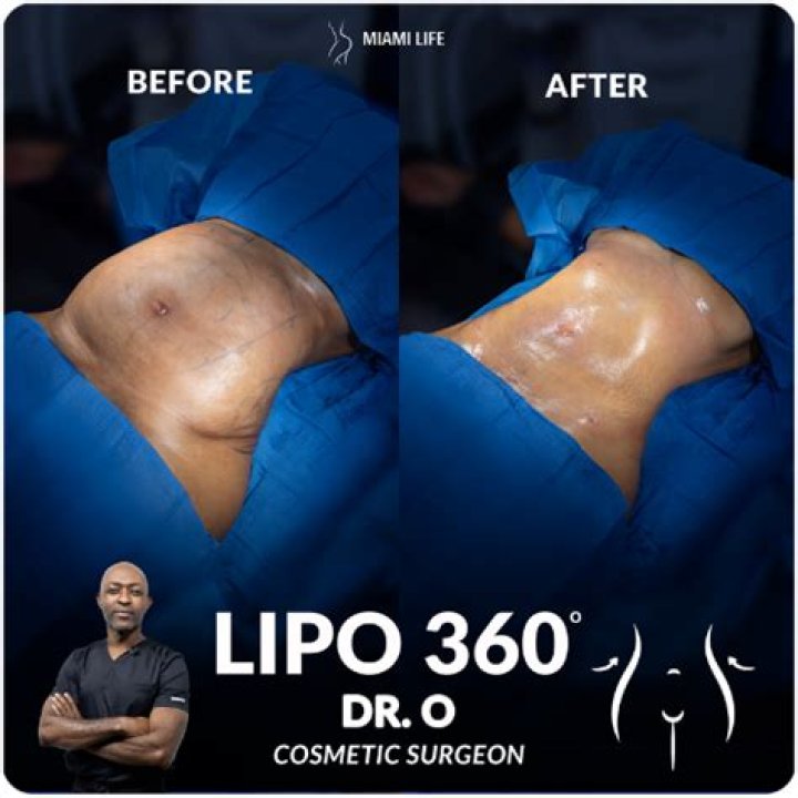 What does a LiPo balance board do?